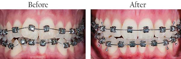 dental images 33193