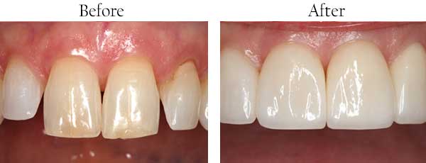 Hammocks dental images